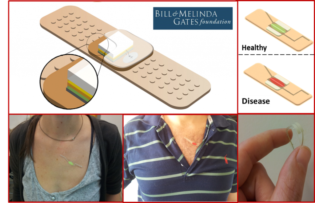 Self-Administered Adhesive Patch for Detection of Tuberculosis - The Bill and Melinda Gates Foundation-Figure 1: (a) Schematic illustration of the envisioned adhesive sensing plaster and its main components. (b) Schematic representation of the readout. Photograph illustrating the output of the device in (c) healthy person and in (d) TB volunteers. (e) A demonstration of the flexibility of the sensing device/plaster achieved in GCE Phase I.